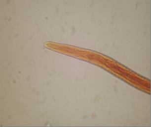 Fig. 1 Anterior end of Haemonchus contortus 3erd stage larve (x400)